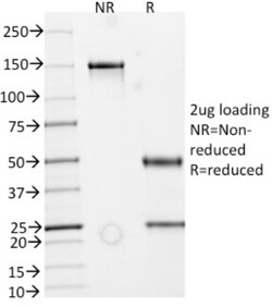 ECM-1/Secretory Component P85 Antibody (ECM1/792), Novus Biologicals 0.2mg;